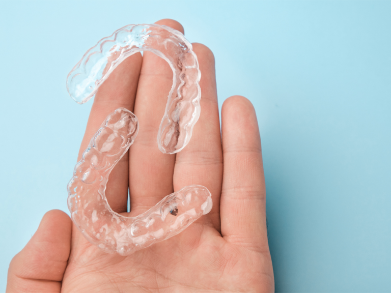 Dental retainers in Hoover, AL at Bluff Park Dental
