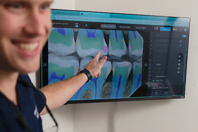 Fillings and Sealants